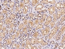 Invitrogen VPS25 Polyclonal Antibody 100 &mu;L; Unconjugated:Antibodies,