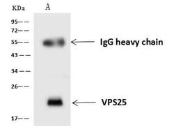 Invitrogen VPS25 Polyclonal Antibody 100 &mu;L; Unconjugated:Antibodies,