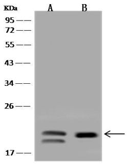 Invitrogen VPS25 Polyclonal Antibody 100 &mu;L; Unconjugated:Antibodies,
