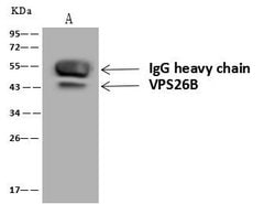 Invitrogen VPS26B Polyclonal Antibody 100 &mu;L; Unconjugated:Antibodies,