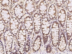 Invitrogen VPS37B Polyclonal Antibody 100 &mu;L; Unconjugated:Antibodies,