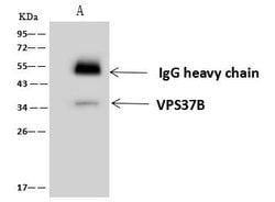 Invitrogen VPS37B Polyclonal Antibody 100 &mu;L; Unconjugated:Antibodies,