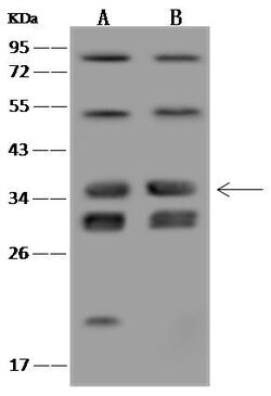 Invitrogen VPS37B Polyclonal Antibody 100 &mu;L; Unconjugated:Antibodies,