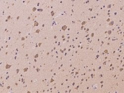 Invitrogen CCDC132 Polyclonal Antibody 100 &mu;L; Unconjugated:Antibodies,