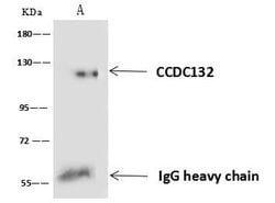 Invitrogen CCDC132 Polyclonal Antibody 100 &mu;L; Unconjugated:Antibodies,