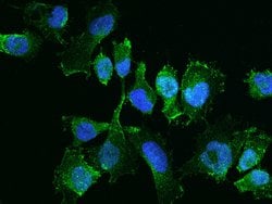 Invitrogen YES1 Polyclonal Antibody 100 &mu;L; Unconjugated:Antibodies,