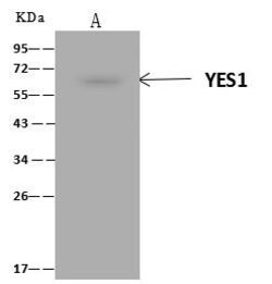 Invitrogen YES1 Polyclonal Antibody 100 &mu;L; Unconjugated:Antibodies,