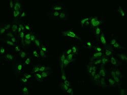 Invitrogen ZNF192 Polyclonal Antibody 100 &mu;L; Unconjugated:Antibodies,