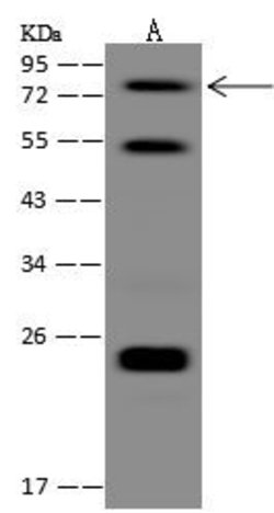 Invitrogen ZMAT1 Polyclonal Antibody 100 &mu;L; Unconjugated:Antibodies,