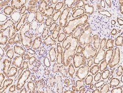 Invitrogen ZNF234 Polyclonal Antibody 100 &mu;L; Unconjugated:Antibodies,