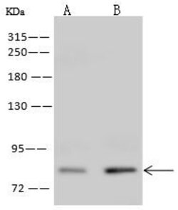 Invitrogen ZNF234 Polyclonal Antibody 100 &mu;L; Unconjugated:Antibodies,