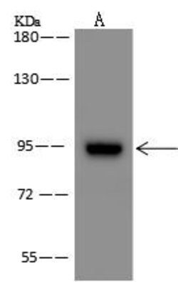 Invitrogen ZNF711 Polyclonal Antibody 100 &mu;L; Unconjugated:Antibodies,