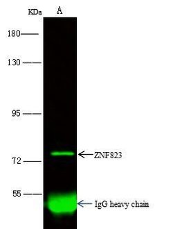 ZNF823 Polyclonal Antibody:Antibodies, Polyclonal