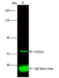 ZNF823 Polyclonal Antibody:Antibodies, Polyclonal