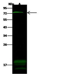 ZNF823 Polyclonal Antibody:Antibodies, Polyclonal