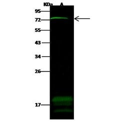ZNF823 Polyclonal Antibody:Antibodies, Polyclonal