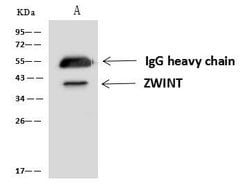 Invitrogen ZWINT Polyclonal Antibody 100 &mu;L; Unconjugated:Antibodies,