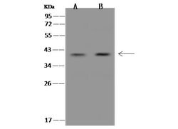 Invitrogen ZWINT Polyclonal Antibody 100 &mu;L; Unconjugated:Antibodies,