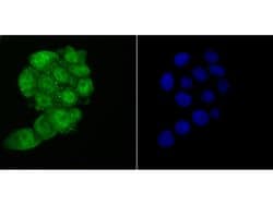 Invitrogen HMGB2 Polyclonal Antibody 100 &mu;L; Unconjugated:Antibodies,