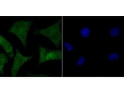 Invitrogen HMGB2 Polyclonal Antibody 100 &mu;L; Unconjugated:Antibodies,