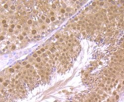 Invitrogen HMGB2 Polyclonal Antibody 100 &mu;L; Unconjugated:Antibodies,
