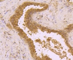 Invitrogen BMAL1 Polyclonal Antibody 100 &mu;L; Unconjugated:Antibodies,
