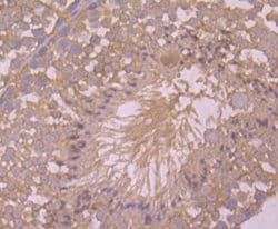 Invitrogen ASK1 Polyclonal Antibody 100 &mu;L; Unconjugated:Antibodies,