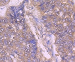 Invitrogen ASK1 Polyclonal Antibody 100 &mu;L; Unconjugated:Antibodies,