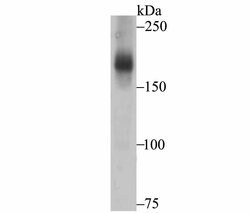 Invitrogen ASK1 Polyclonal Antibody 100 &mu;L; Unconjugated:Antibodies,