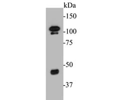 Invitrogen FOXP1 Polyclonal Antibody 100 &mu;L | Buy Online | Invitrogen&trade; | Fisher Scientific