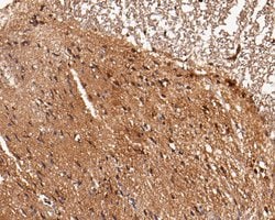 Invitrogen LGI1 Polyclonal Antibody 100 &mu;L; Unconjugated:Antibodies,