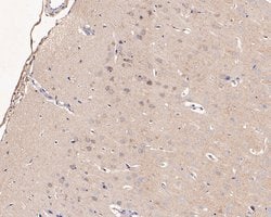 Invitrogen LGI1 Polyclonal Antibody 100 &mu;L; Unconjugated:Antibodies,