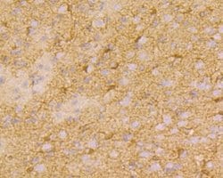 Connexin 37 Polyclonal Antibody:Antibodies, Polyclonal