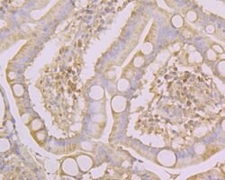 Connexin 37 Polyclonal Antibody:Antibodies, Polyclonal