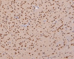 Invitrogen COPS8 Polyclonal Antibody 100 &mu;L; Unconjugated:Antibodies,