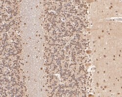 Invitrogen COPS8 Polyclonal Antibody 100 &mu;L; Unconjugated:Antibodies,