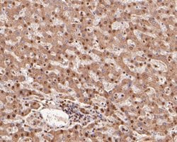 Invitrogen COPS8 Polyclonal Antibody 100 &mu;L; Unconjugated:Antibodies,