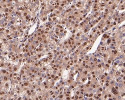 Invitrogen COPS8 Polyclonal Antibody 100 &mu;L; Unconjugated:Antibodies,