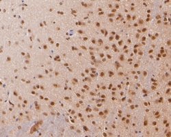 Invitrogen COPS8 Polyclonal Antibody 100 &mu;L; Unconjugated:Antibodies,