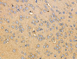 Invitrogen Phospho-RIP2 (Ser176) Polyclonal Antibody 100 &mu;L; Unconjugated:Antibodies,