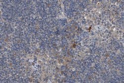 Invitrogen Phospho-RIP2 (Ser176) Polyclonal Antibody 100 &mu;L; Unconjugated:Antibodies,