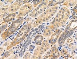 Invitrogen Phospho-RIP2 (Ser176) Polyclonal Antibody 100 &mu;L; Unconjugated:Antibodies,