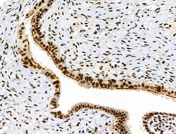 Invitrogen Phospho-RARA (Ser77) Polyclonal Antibody 100 &mu;L; Unconjugated:Antibodies,