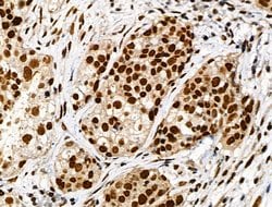 Invitrogen Phospho-RARA (Ser77) Polyclonal Antibody 100 &mu;L; Unconjugated:Antibodies,