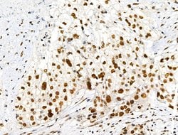 Invitrogen Phospho-RARA (Ser77) Polyclonal Antibody 100 &mu;L; Unconjugated:Antibodies,
