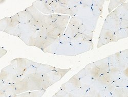 Invitrogen Phospho-EPS15 (Tyr849) Polyclonal Antibody 100 &mu;L; Unconjugated:Antibodies,