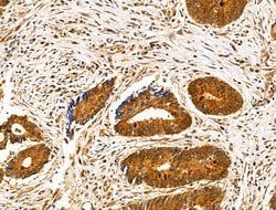 Invitrogen SENP8 Polyclonal Antibody 100 &mu;L; Unconjugated:Antibodies,