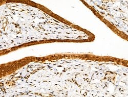 Invitrogen SENP8 Polyclonal Antibody 100 &mu;L; Unconjugated:Antibodies,