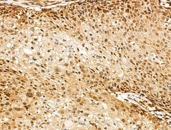 Invitrogen SENP8 Polyclonal Antibody 100 &mu;L; Unconjugated:Antibodies,