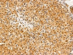 Invitrogen SENP8 Polyclonal Antibody 100 &mu;L; Unconjugated:Antibodies,